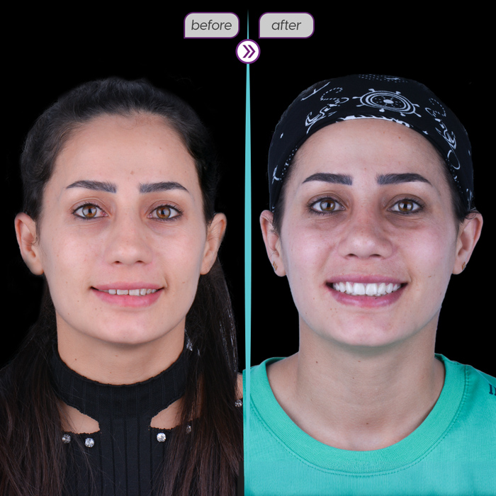 Before after case